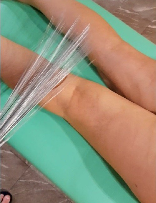 Даосский вибрационный массаж металлическим веником